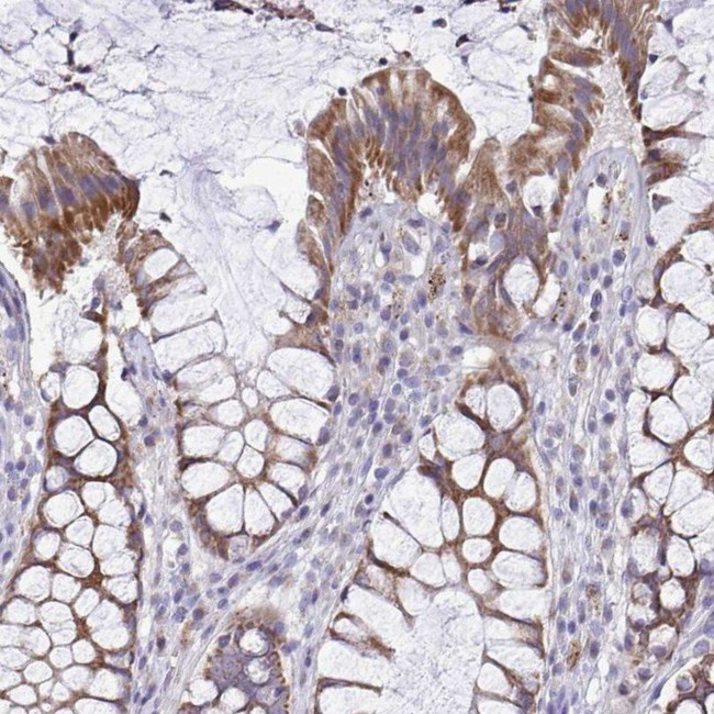 MRPS16 Antibody in Immunohistochemistry (IHC)