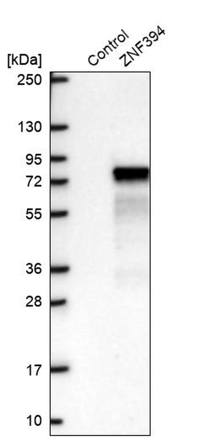 ZNF394 Antibody in Western Blot (WB)