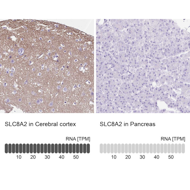 SLC8A2 Antibody in Immunohistochemistry (IHC)