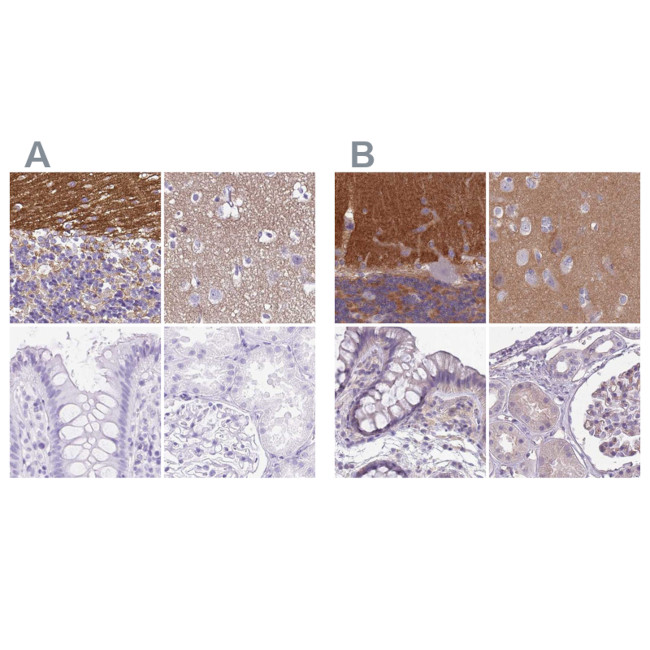 SLC8A2 Antibody in Immunohistochemistry (IHC)