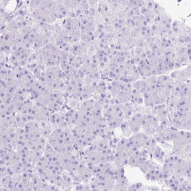 SLC8A2 Antibody in Immunohistochemistry (IHC)