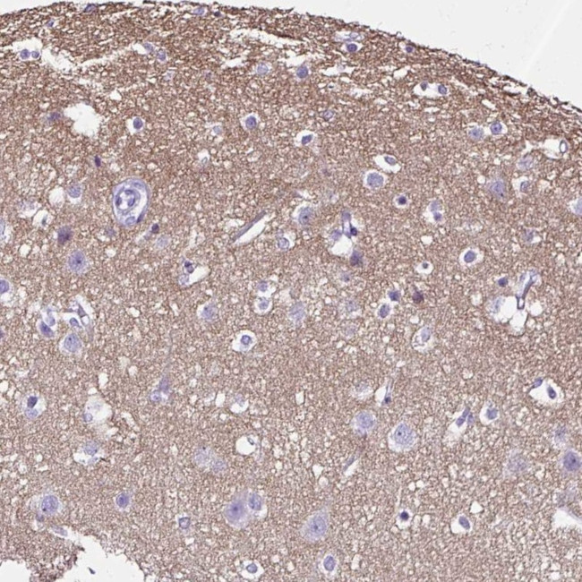 SLC8A2 Antibody in Immunohistochemistry (IHC)