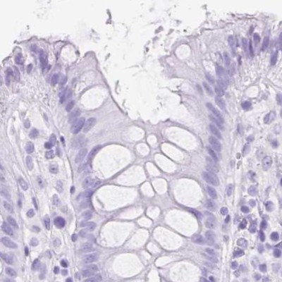 SLC8A2 Antibody in Immunohistochemistry (IHC)