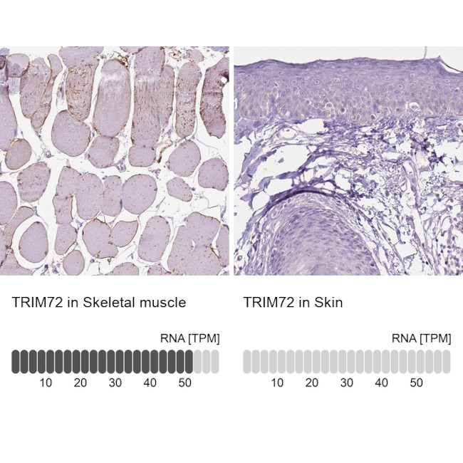 TRIM72 Antibody in Immunohistochemistry (IHC)