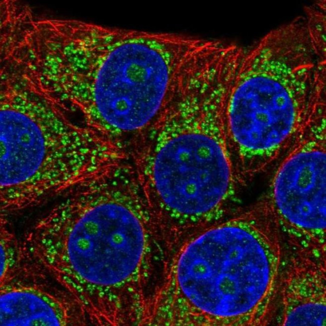 B3GNT4 Antibody in Immunocytochemistry (ICC/IF)