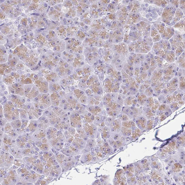 FTSJ3 Antibody in Immunohistochemistry (Paraffin) (IHC (P))