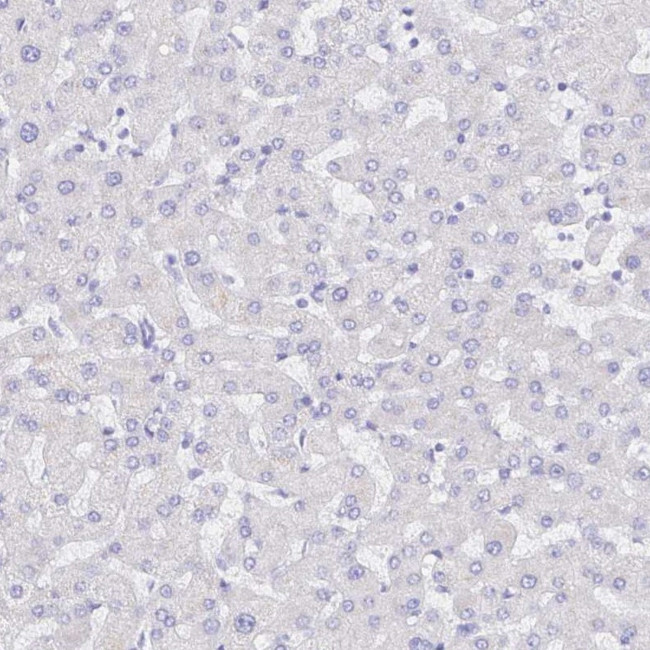 S100G Antibody in Immunohistochemistry (IHC)