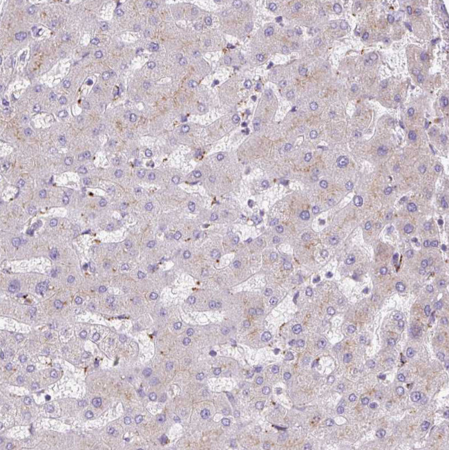 HEXB Antibody in Immunohistochemistry (IHC)