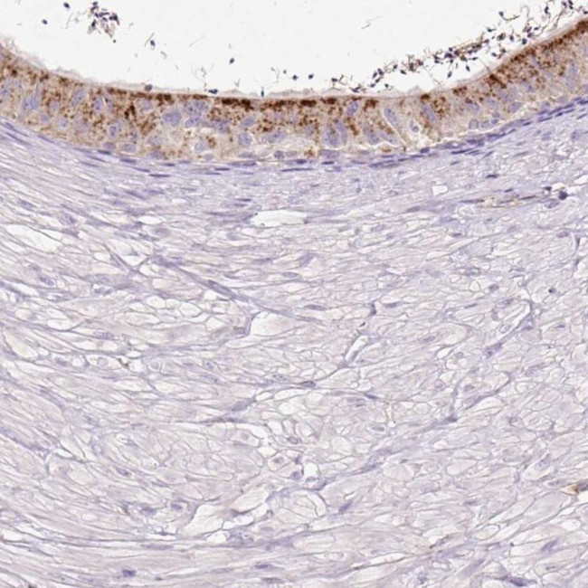 HEXB Antibody in Immunohistochemistry (IHC)