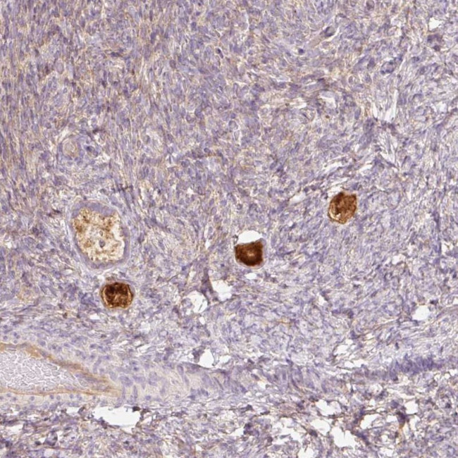 NALP5 Antibody in Immunohistochemistry (Paraffin) (IHC (P))