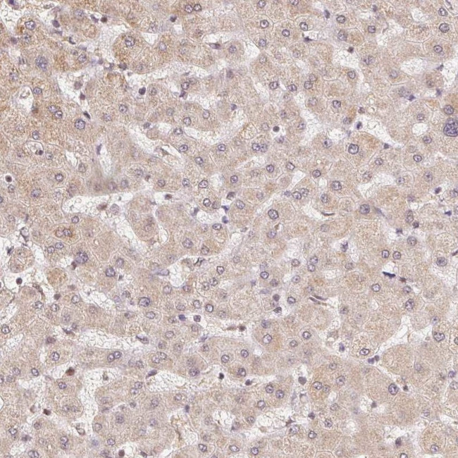 PIWIL4 Antibody in Immunohistochemistry (IHC)