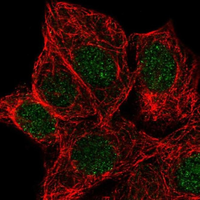 KCNK5 Antibody in Immunocytochemistry (ICC/IF)