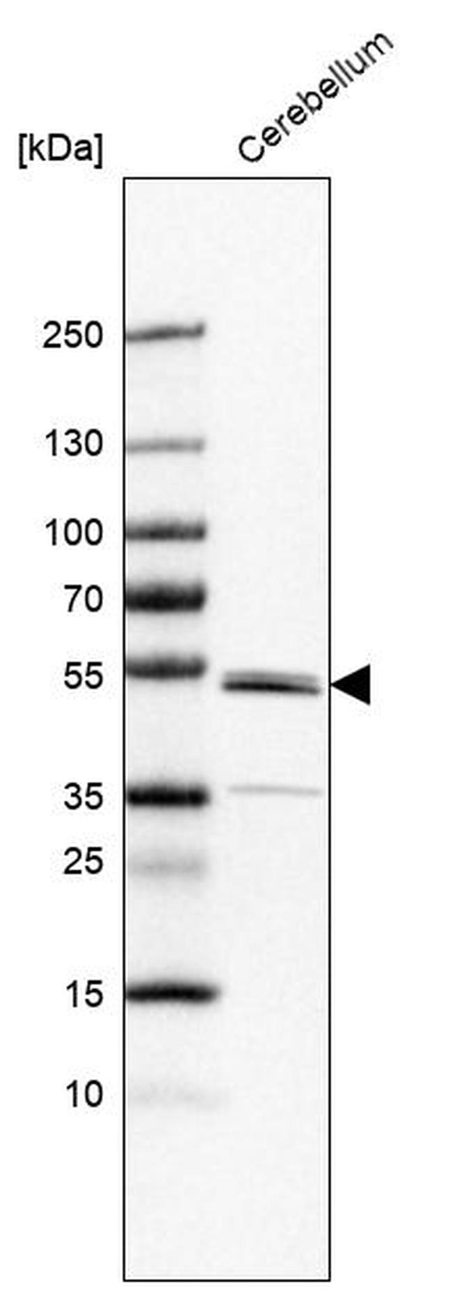 ZN692 Antibody in Western Blot (WB)