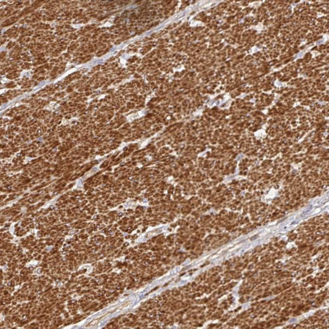 METTL22 Antibody in Immunohistochemistry (Paraffin) (IHC (P))