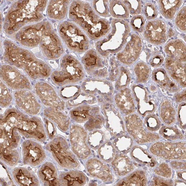 DCST1 Antibody in Immunohistochemistry (Paraffin) (IHC (P))