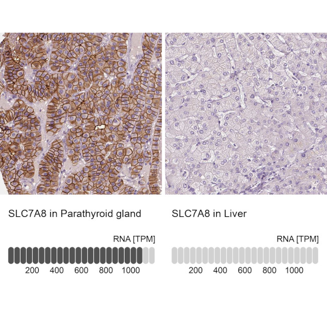 SLC7A8 Antibody in Immunohistochemistry (IHC)