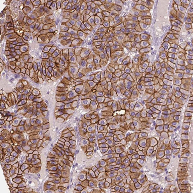 SLC7A8 Antibody in Immunohistochemistry (IHC)