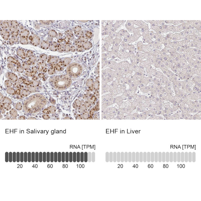 EHF Antibody in Immunohistochemistry (IHC)