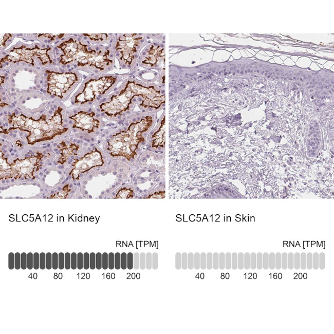 SLC5A12 Antibody in Immunohistochemistry (IHC)