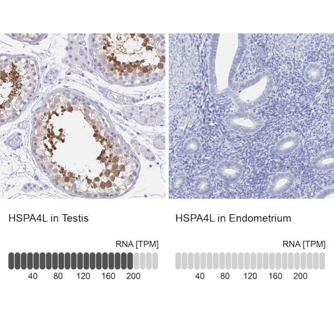 HSPA4L Antibody in Immunohistochemistry (IHC)