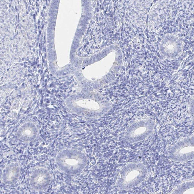 HSPA4L Antibody in Immunohistochemistry (IHC)