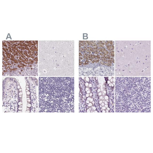 FDX1 Antibody in Immunohistochemistry (IHC)