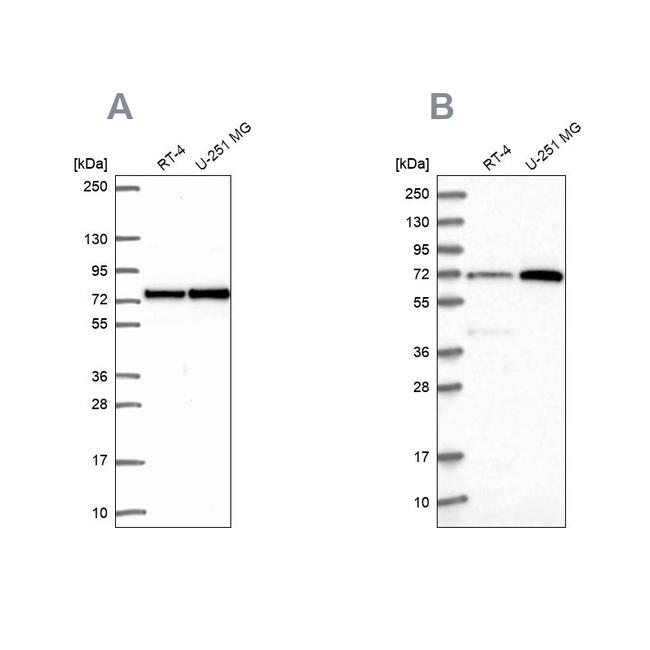 PES1 Antibody in Western Blot (WB)