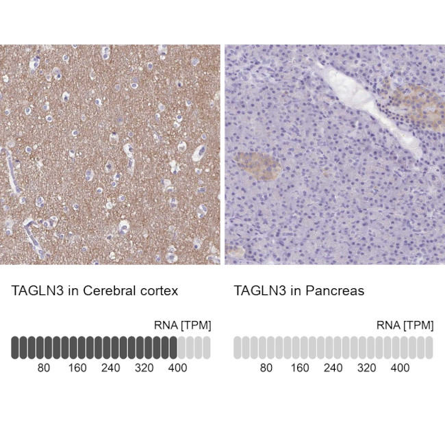 TAGLN3 Antibody in Immunohistochemistry (IHC)