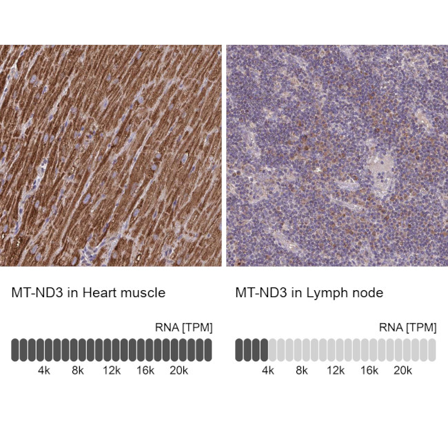 MT-ND3 Antibody in Immunohistochemistry (IHC)