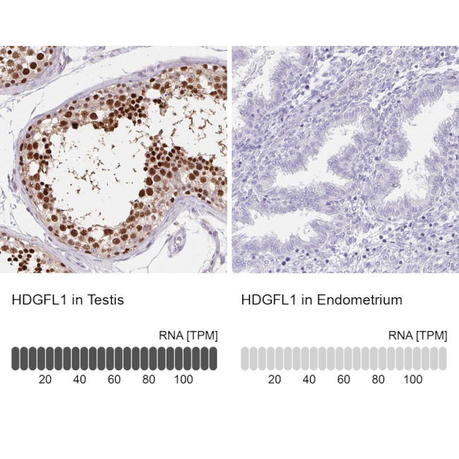 HDGFL1 Antibody in Immunohistochemistry (IHC)