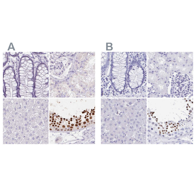 HDGFL1 Antibody in Immunohistochemistry (IHC)