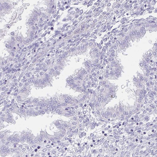 HDGFL1 Antibody in Immunohistochemistry (IHC)