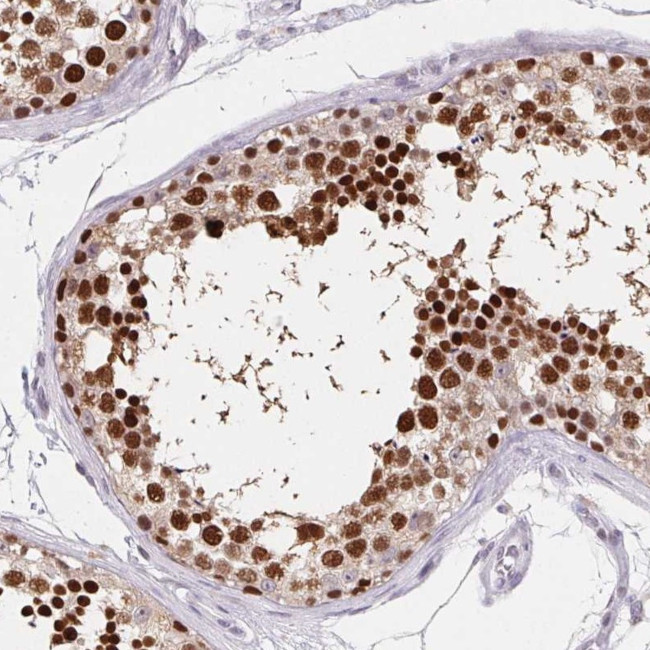 HDGFL1 Antibody in Immunohistochemistry (IHC)