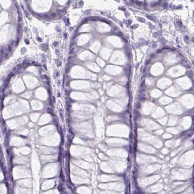 HDGFL1 Antibody in Immunohistochemistry (IHC)