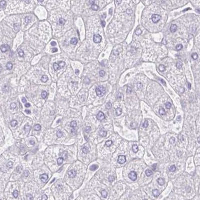 HDGFL1 Antibody in Immunohistochemistry (IHC)