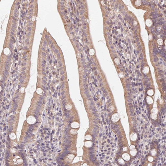 NCOA4 Antibody in Immunohistochemistry (Paraffin) (IHC (P))