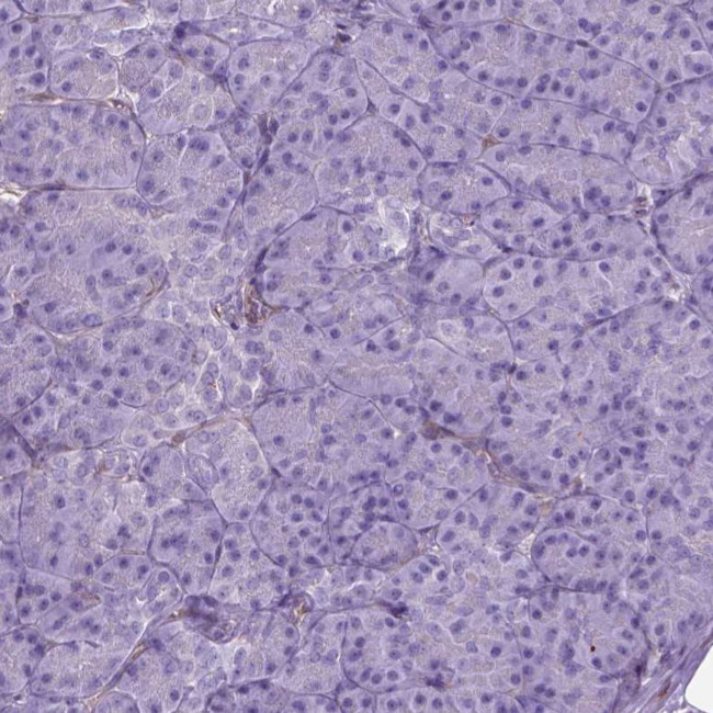 AMOT Antibody in Immunohistochemistry (IHC)