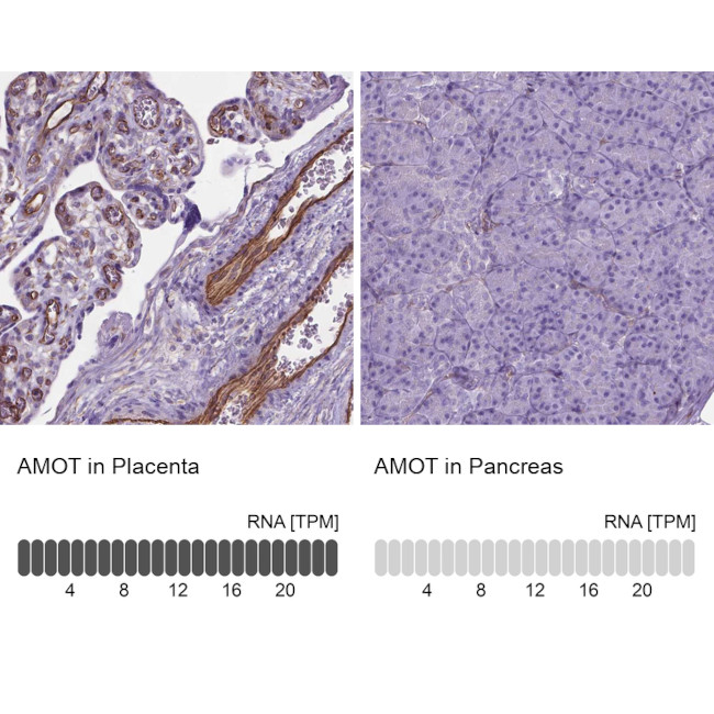 AMOT Antibody