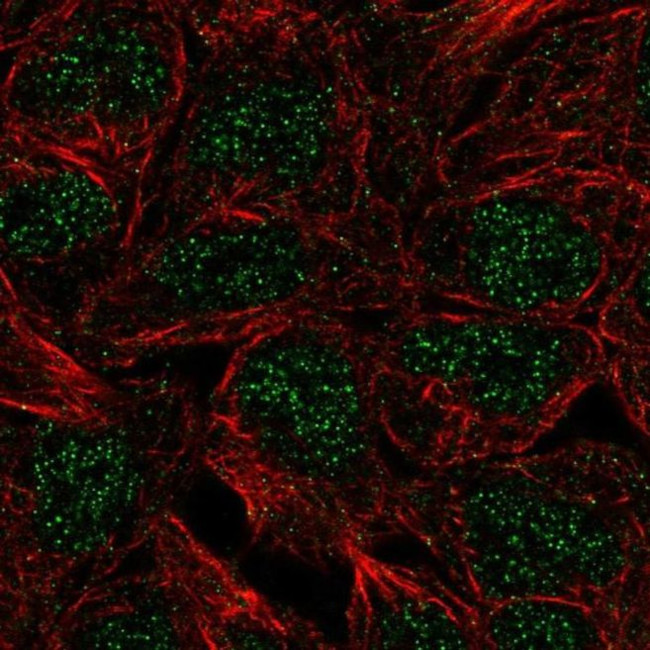 CTR9 Antibody in Immunocytochemistry (ICC/IF)