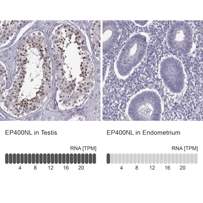 EP400NL Antibody in Immunohistochemistry (IHC)