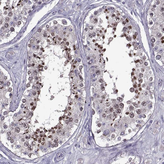 EP400NL Antibody in Immunohistochemistry (IHC)