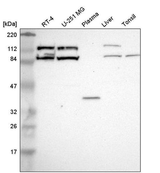 CLC-5 Antibody in Western Blot (WB)