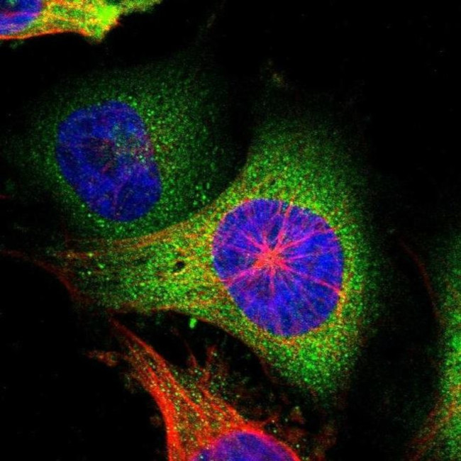 WARS Antibody in Immunocytochemistry (ICC/IF)