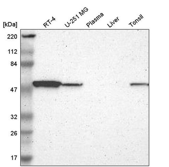 WARS Antibody in Western Blot (WB)