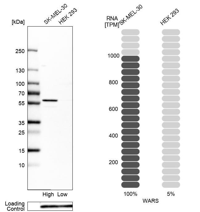 WARS Antibody