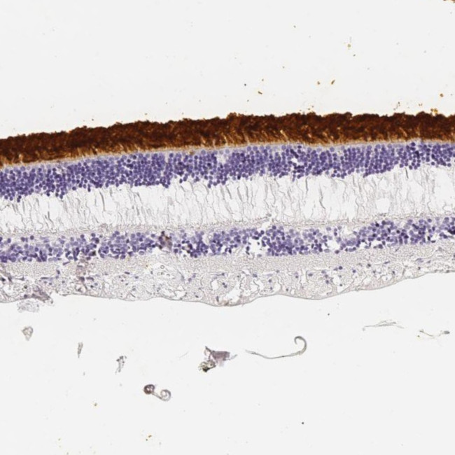 IMPG2 Antibody in Immunohistochemistry (Paraffin) (IHC (P))