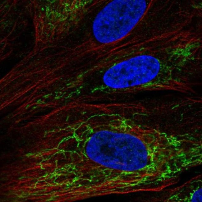 MGARP Antibody in Immunocytochemistry (ICC/IF)