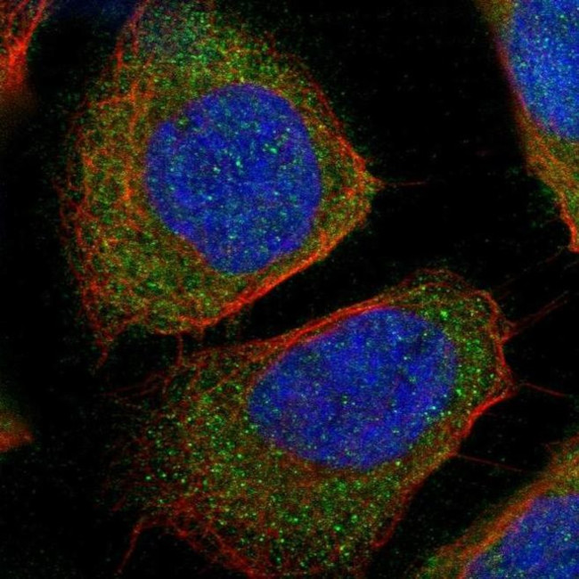 WARS Antibody in Immunocytochemistry (ICC/IF)