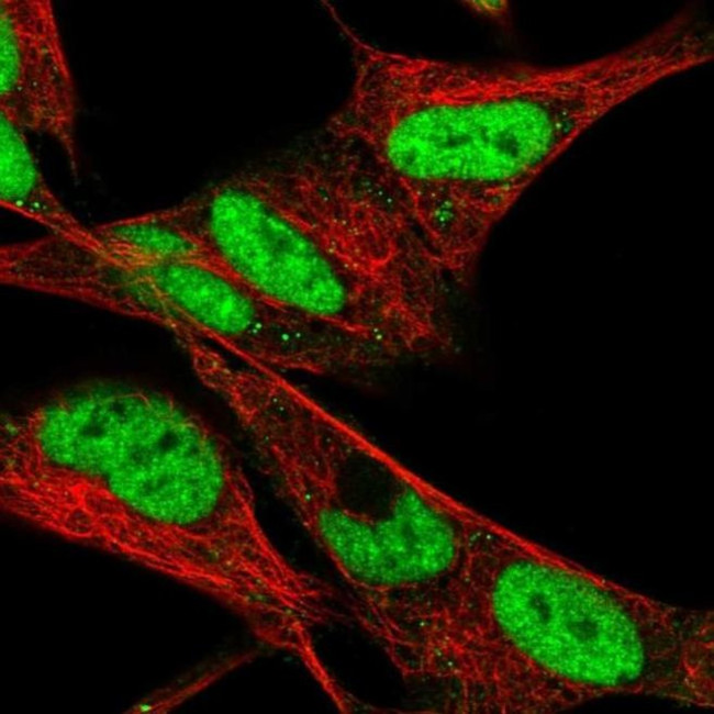 HAND2 Antibody in Immunocytochemistry (ICC/IF)