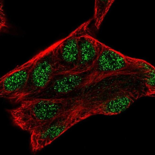 ZMAT3 Antibody in Immunocytochemistry (ICC/IF)